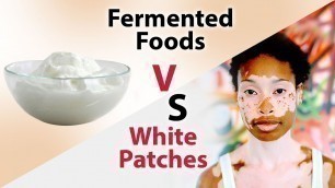 'Impact of Fermented Foods on White Patches – Dr. Nitika Kohli – AIMIL'