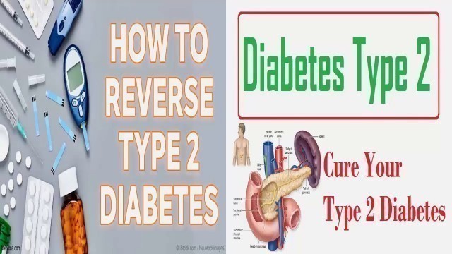 'Diabetic Diet Chart - Type 2 Diabetes Diet Plan- Sample Diabetes Meal plan | diabetic diet'